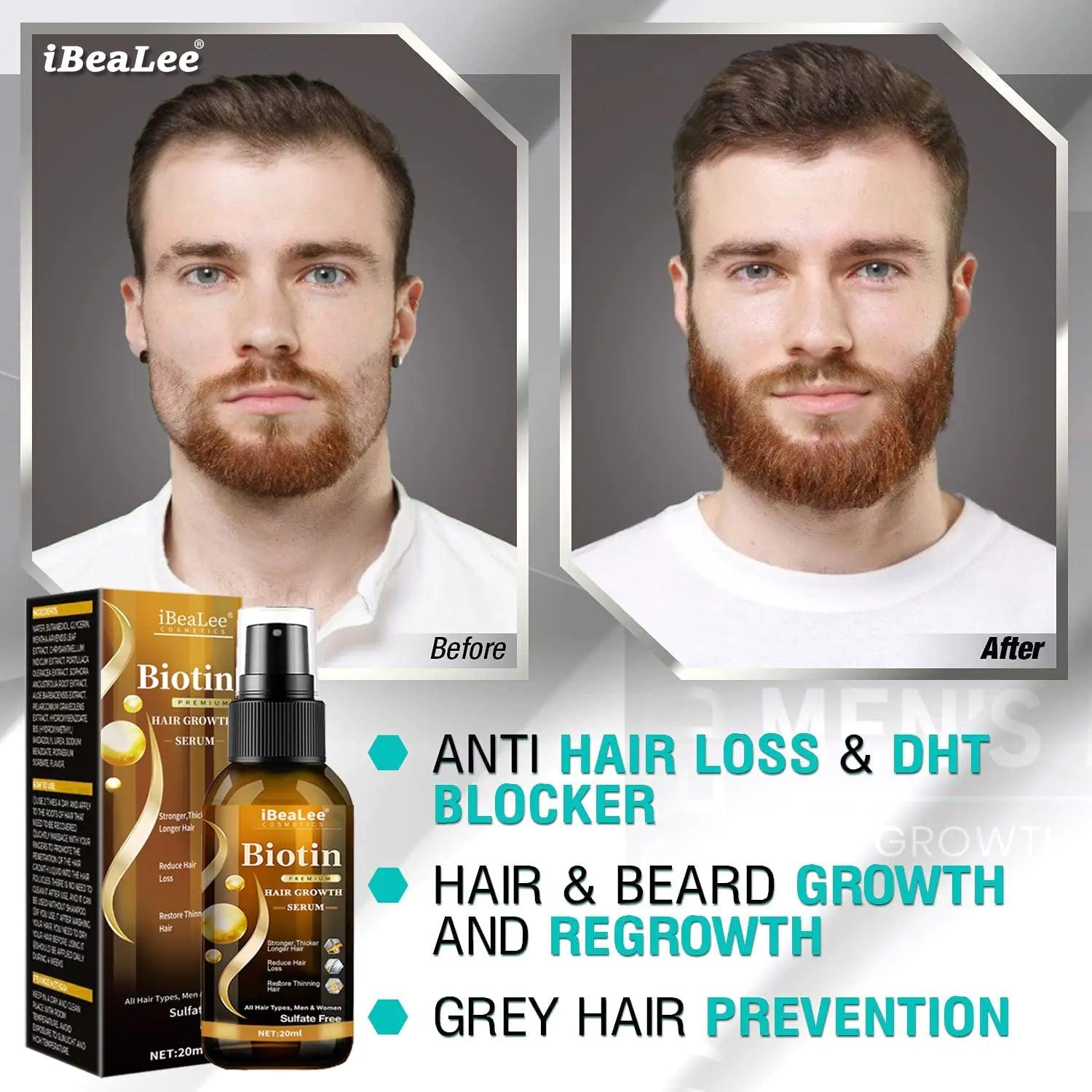 Hair Care Essential Growth Oils for Men and Women - EverYouth Essentials