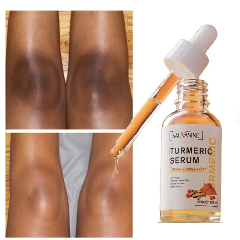 Natural Glow Serum: Turmeric Infused Skincare Solution - EverYouth Essentials