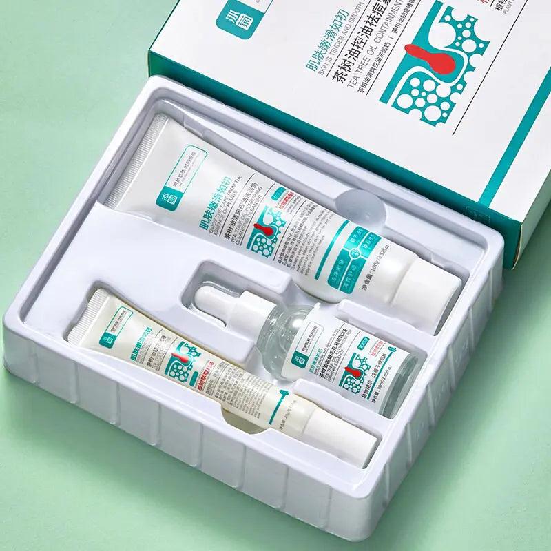 Anti Acne Removal Moisturizing Face Skin Care Kit - EverYouth Essentials