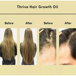 Thrive Hair Growth Essential Oil - EverYouth Essentials