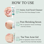 Anti Acne Removal Moisturizing Face Skin Care Kit - EverYouth Essentials