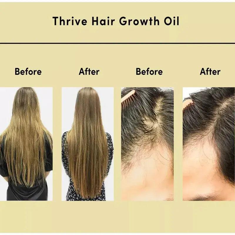 Thrive Hair Growth Essential Oil - EverYouth Essentials